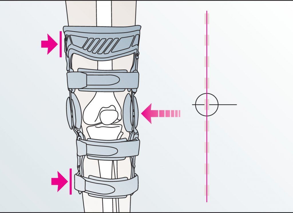 4s укороченый. Орлетт ортез на коленный сустав hks-303. Тутор коленного сустава как правильно. Тутор послеоперационный knee ranger 79-94040. Тутор е-8535.