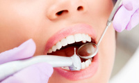 Лечение поверхностного кариеса постоянного зуба